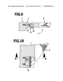 Intervertebral implant diagram and image