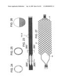 EMBOLIC PROTECTION DEVICE diagram and image