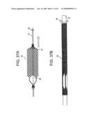 EMBOLIC PROTECTION DEVICE diagram and image