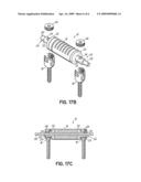 FLEXIBLE MEMBER WITH VARIABLE FLEXIBILITY FOR PROVIDING DYNAMIC STABILITY TO A SPINE diagram and image