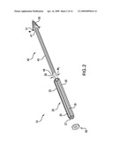 METHODS OF STABILIZING THE SACROILIAC JOINT diagram and image