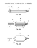 METHODS OF STABILIZING THE SACROILIAC JOINT diagram and image