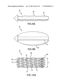 METHODS OF STABILIZING THE SACROILIAC JOINT diagram and image