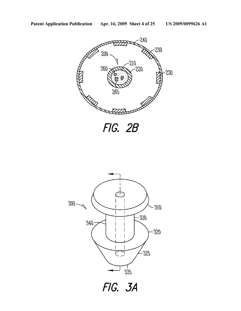 Lacrimal implant detection - diagram, schematic, and image 05