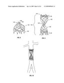 WOVEN INTRAVASCULAR DEVICES AND METHODS FOR MAKING THE SAME diagram and image