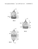 WOVEN INTRAVASCULAR DEVICES AND METHODS FOR MAKING THE SAME diagram and image