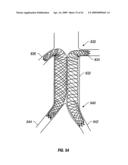 WOVEN INTRAVASCULAR DEVICES AND METHODS FOR MAKING THE SAME diagram and image