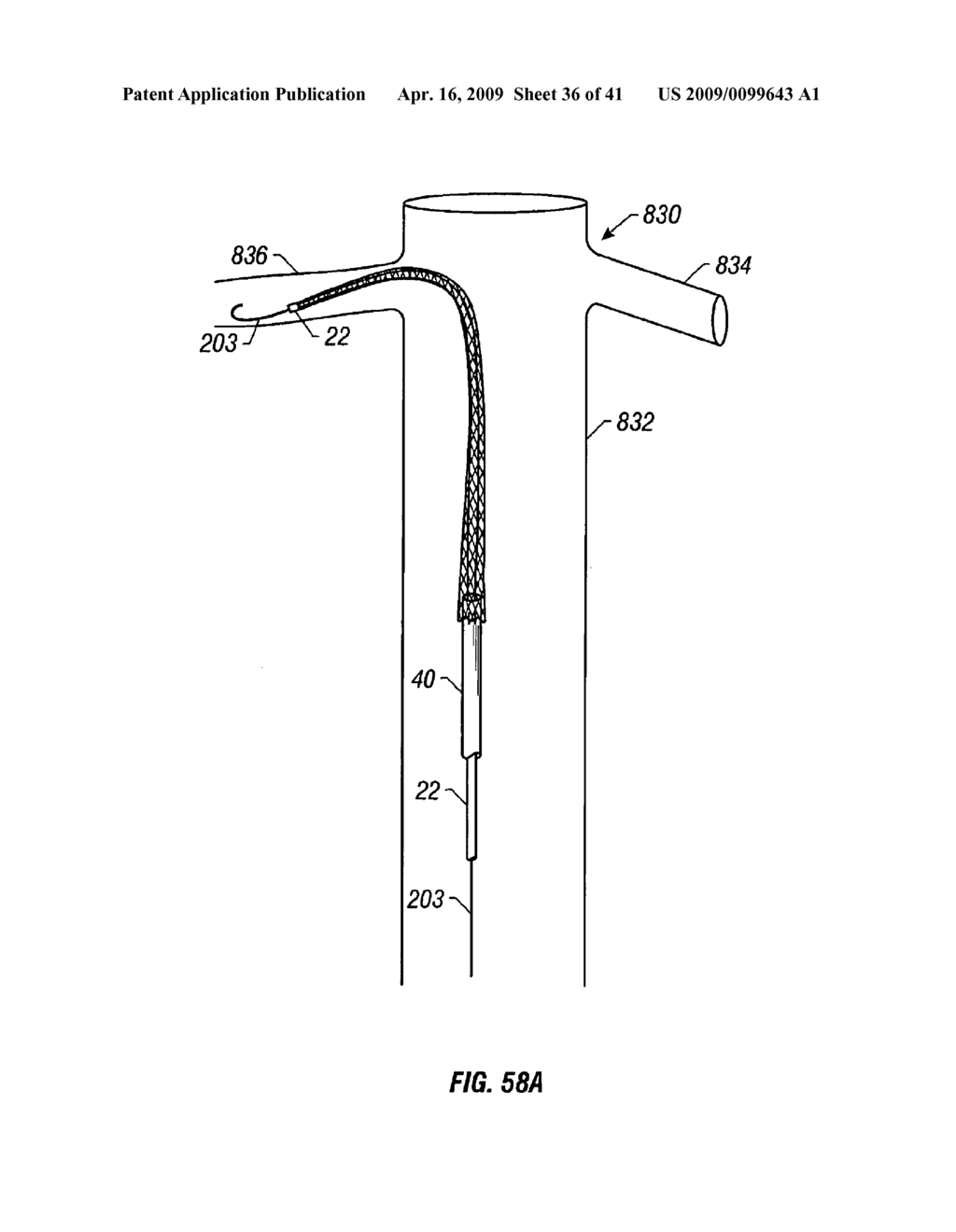 WOVEN INTRAVASCULAR DEVICES AND METHODS FOR MAKING THE SAME - diagram, schematic, and image 37