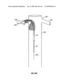 WOVEN INTRAVASCULAR DEVICES AND METHODS FOR MAKING THE SAME diagram and image