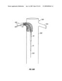 WOVEN INTRAVASCULAR DEVICES AND METHODS FOR MAKING THE SAME diagram and image