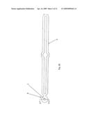 COVERED STENT diagram and image