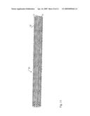 COVERED STENT diagram and image