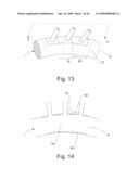 Modular stent graft and delivery system diagram and image