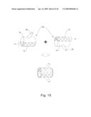 Modular stent graft and delivery system diagram and image