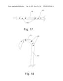 Modular stent graft and delivery system diagram and image