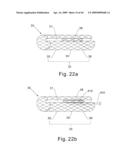 Modular stent graft and delivery system diagram and image