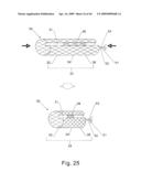 Modular stent graft and delivery system diagram and image