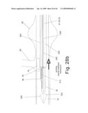 Modular stent graft and delivery system diagram and image