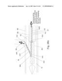 Modular stent graft and delivery system diagram and image