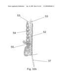 Modular stent graft and delivery system diagram and image