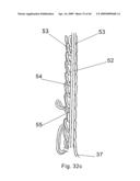 Modular stent graft and delivery system diagram and image