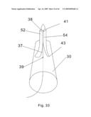 Modular stent graft and delivery system diagram and image