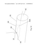 Modular stent graft and delivery system diagram and image