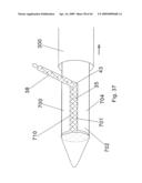 Modular stent graft and delivery system diagram and image