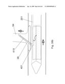 Modular stent graft and delivery system diagram and image