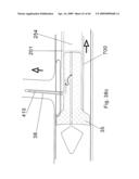 Modular stent graft and delivery system diagram and image