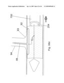 Modular stent graft and delivery system diagram and image