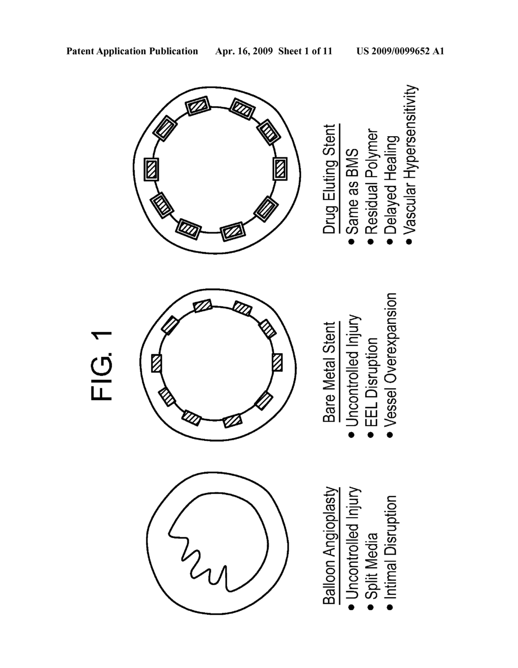 Composite Vascular Prosthesis - diagram, schematic, and image 02