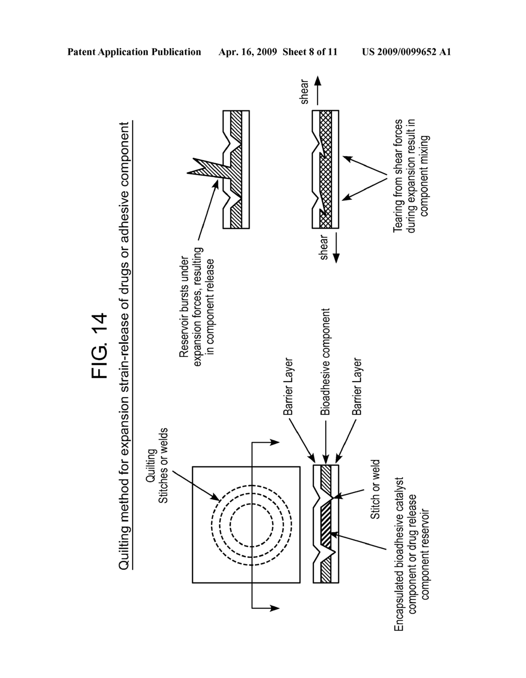 Composite Vascular Prosthesis - diagram, schematic, and image 09