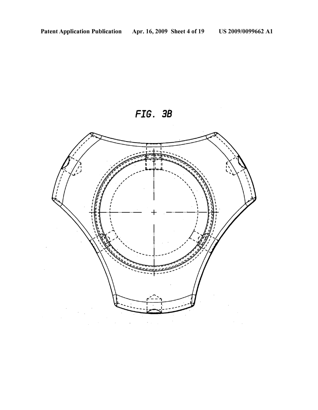 Expandable reverse shoulder trial - diagram, schematic, and image 05