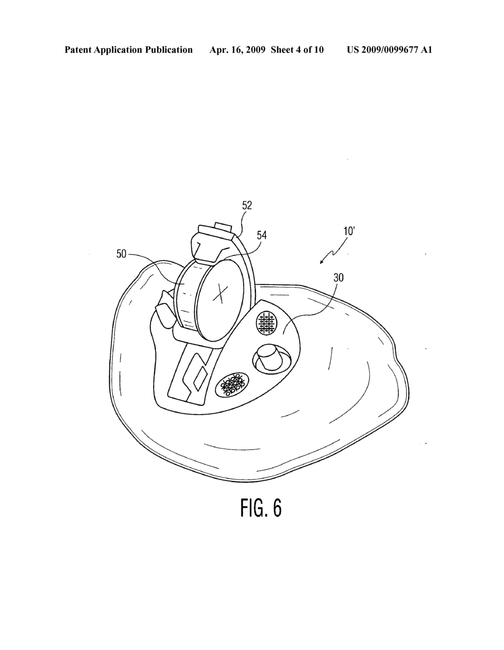 Method For Anatomically Aware Automatic Faceplate Placement Protocols for Hearing Instrument Design - diagram, schematic, and image 05