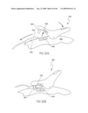 Respiratory Mask Assembly with Magnetic Coupling to Headgear Assembly diagram and image