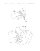 VAGINAL SHIELD diagram and image