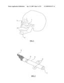 Bioresorbable Inflatable Devices, Incision Tool And Methods For Tissue Expansion And Tissue Regeneration diagram and image