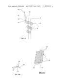 Bioresorbable Inflatable Devices, Incision Tool And Methods For Tissue Expansion And Tissue Regeneration diagram and image