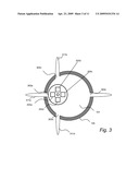 MULTILAYERED BALL SEALER AND METHOD OF USE THEREOF diagram and image