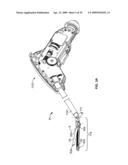 Surgical Device diagram and image