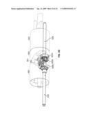 Surgical Device diagram and image