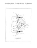 External Pressure Gasket diagram and image