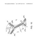 Gasket diagram and image