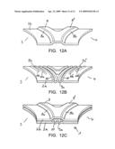 Gasket diagram and image