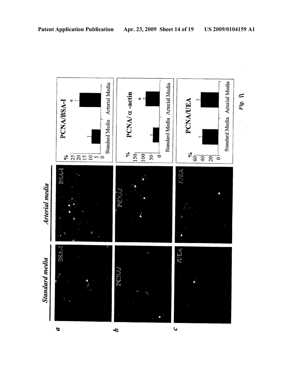 Vascular/Lymphatic Endothelial Cells - diagram, schematic, and image 15