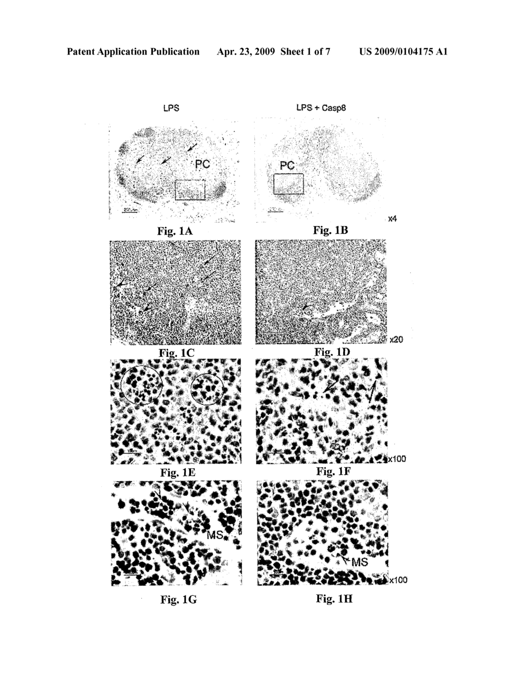 USE OF CASPASES FOR THE PREPARATION OF MEDICAMENTS - diagram, schematic, and image 02