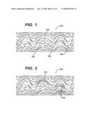  LOCAL ADMINISTRATION OF A COMBINATION OF RAPAMYCIN AND PANZEM FOR THE TREATMENT OF VULNERABLE PLAQUE diagram and image