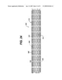  LOCAL ADMINISTRATION OF A COMBINATION OF RAPAMYCIN AND PANZEM FOR THE TREATMENT OF VULNERABLE PLAQUE diagram and image