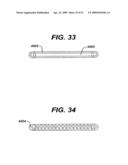  LOCAL ADMINISTRATION OF A COMBINATION OF RAPAMYCIN AND PANZEM FOR THE TREATMENT OF VULNERABLE PLAQUE diagram and image